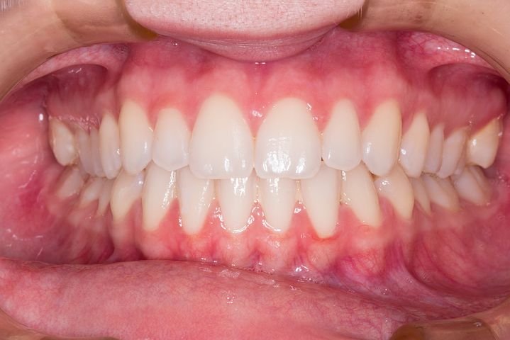 procedimento odontológico